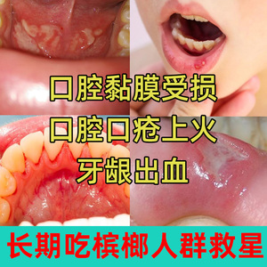 榔子伴侣牙膏仁云堂植物改善牙龈出血红肿治吃槟榔口腔粘膜修复用