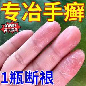 专治手鲜特效药皮肤癣药膏外用牛皮藓银屑湿疹膏成人湿疹止痒去根