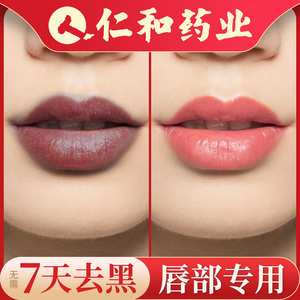 【嘴角暗沉黑色素】嘴角暗沉黑色素品牌,价格 - 阿里巴巴