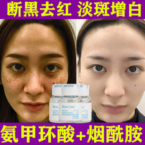 氨甲环酸精华液去黄褐斑祛斑传明酸淡化黑色素改善暗沉官方旗舰店