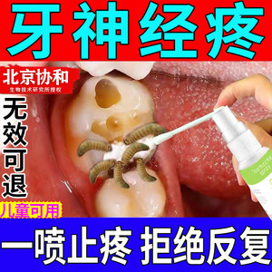 牙龈肿痛牙膏药治牙周炎牙髓炎速消效止痛智齿抗敏神经jy43人付款59