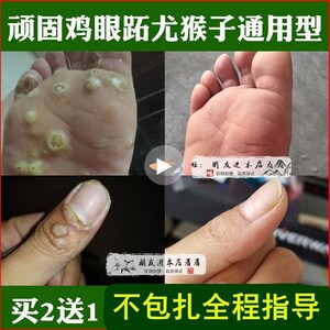 去除猴子刺猴肉手部