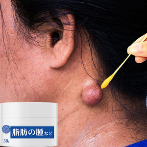 日本脂肪瘤消瘤膏脂肪粉瘤去除神器全身皮下多发性消除硬块瘤克星