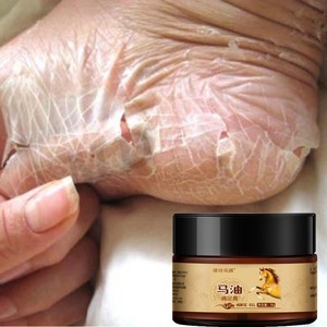 脚掉皮脱皮脚臭