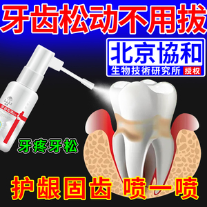 牙齿松动的治牙龈肿痛萎缩专用牙膏痛晃动固齿牙疼可搭配膏药贴MM