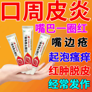 口周皮炎儿童烂嘴角唇炎唇膏口角炎嘴角疱疹干裂起皮疼痛非药膏sj