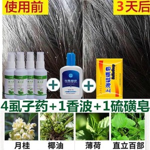 灭虱灵去儿童杀捉除清治洗小女孩卷头发上长有虫子头虱虱子药必净