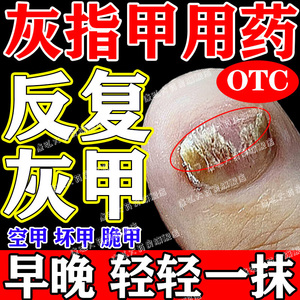灰指甲专用药药膏