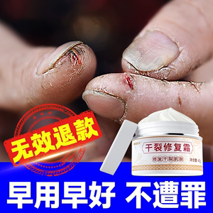 手裂口干裂修复霜手指头裂口子皲裂膏冬季指甲缝开裂手足裂开防裂