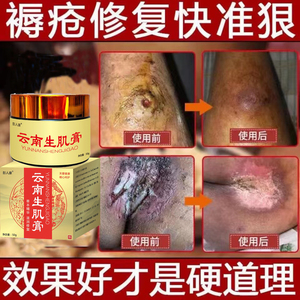 0012人付款淘宝2送1兆春牌化腐生肌膏正品去腐生肌育肤膏愈皮膏烧烫伤