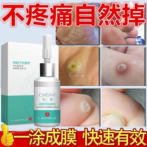 初妮鸦胆子抗菌剂抗菌膏仁软膏祛鸡眼刺瘊去除足部神器脚底手茧.