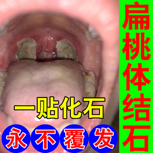 喉咙有白点是什么原因图片