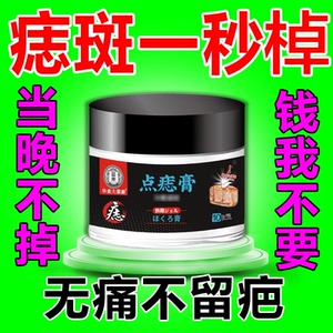 去痣点痣祛痣无痕正品脸部药膏疤痕修复祛斑点痣专用药水神器wq