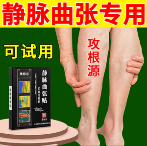 静脉曲张膏药贴腿部外用小腿疼痛酸麻肿胀青筋凸起蚯蚓腿专用膏药