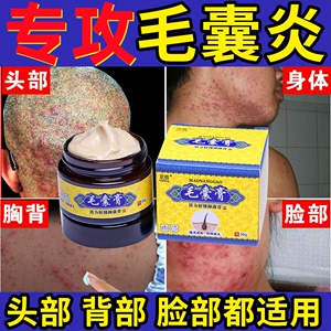 日本小林制鸡皮膏疙瘩膏胳膊皮肤去角质软化毛囊膏持久保湿