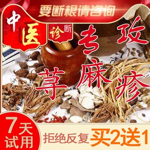 荨麻疹过敏止痒断根日本风团克星胆碱能性根源治疗寻皮肤专用药膏