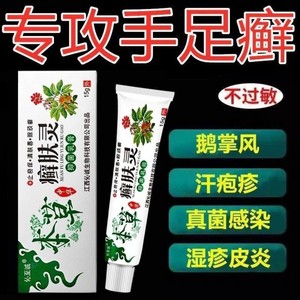 手足癣手上起小水泡手痒脱皮干裂鹅掌风伈至诚本草癣肤灵抑菌乳膏