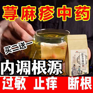 荨麻方子疹茶急慢性寻荨麻疹过敏止痒断膏根专用过敏茶性胆碱能性