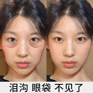 【李佳琪推荐 告别凹陷】面部丰盈原液 去泪沟神器 收缩眼袋