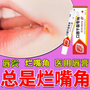 唇膏口角炎儿童烂嘴角溃疡疱疹开裂干燥起皮润唇膏修护唇炎用药膏