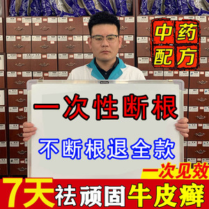 治疗牛皮廯藓银屑病止痒抑菌皮肤瘙痒湿疹去根股体癣专用祛癣药膏