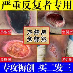 玉红生肌膏同仁堂褥搓疮膏特效伤口愈和合老烂腿老人臀部正品