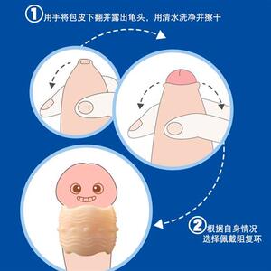 包皮阻复环矫正器