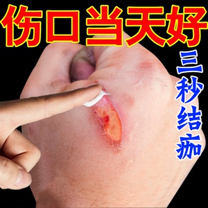 祛腐生肌膏促进伤口结痂快速修复愈合杀菌烫伤烧伤消毒水消焱药膏