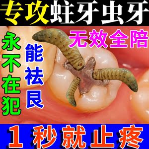牙痛止疼药速效杀牙虫消牙疼神器虫牙专用炎牙龈肿痛烂牙蛀牙喷剂