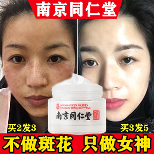 荣养祛斑膏容祛斑霜同仁堂消斑润肤色斑雀斑提亮肤色176171176