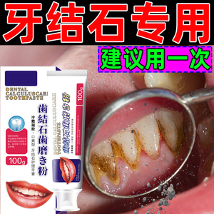 牙结石专用牙膏牙齿松动牙龈出血萎缩治红肿痛修护牙周炎去口臭vv