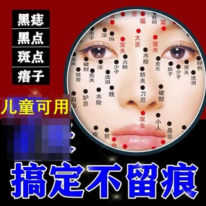 点痣专用的药膏去痣祛斑无痕正品脸部去除肉痣黑点痦子瘊子神器