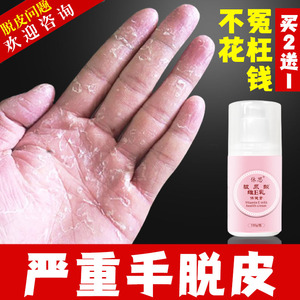 手脱皮的药修复霜