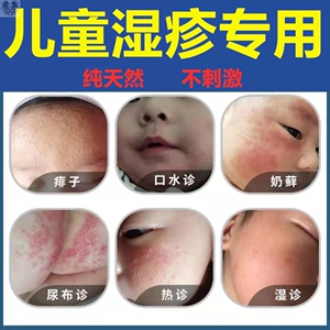 00tb032337046淘宝治疗白色糠疹皮炎婴儿湿疹专用药膏止痒抑菌皮肤