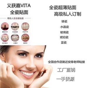 美加义获嘉超薄全瓷emax贴面牙齿美白贴片进口烤瓷冰瓷牙假牙韩国