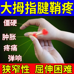 大拇指腱鞘炎专用膏手指疼痛舒贴喷雾关节疼痛肿健鞘炎大母一指cy