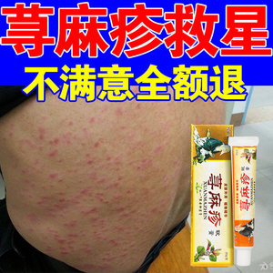 荨麻疹过敏止痒断根专用药膏慢性丘疹性荨麻疹克星中药成人儿童