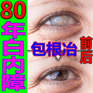 白内障滴眼液专用眼药水治疗老人视力模糊玻璃体晶体混浊日本进口