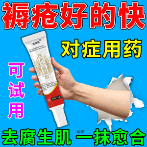 褥疮专用药膏促进伤口愈合卧床老人老烂腿臀部溃烂流脓去腐生肌膏