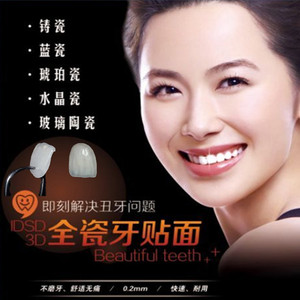 义获嘉超薄全瓷贴面牙贴美学进口假牙贴片美白修复牙缝冰瓷贴片