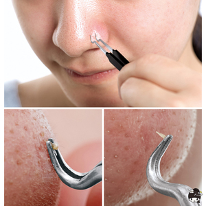 夹黑头粉刺的镊子神器日本