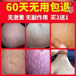 美腹修复乳颈纹妊辰纹仪器去妊辰l纹神器产后按摩膏修复