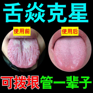 地图舌裂纹舌调理儿童舌头黏膜发炎舌苔乳头增厚破裂沟疼痛烧灼感