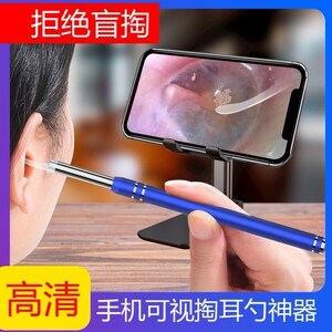 可视采耳仪器耳镜