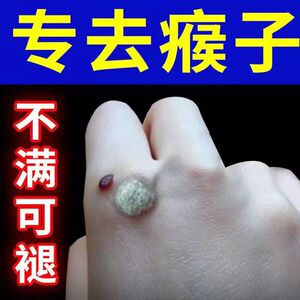 【一抹就消】去猴子脖子上长的小肉粒疙瘩药神器腋下祛除瘊子疣瘊