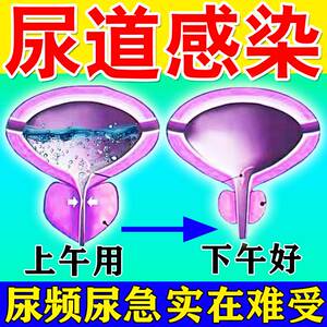 尿道炎男女尿路感染膀胱炎贴尿痛尿频尿急尿不尽尿分叉专用膏药贴