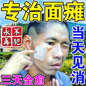 面瘫贴牵正散专用膏药面部按摩大小眼嘴歪口眼联动后遗症恢复神器