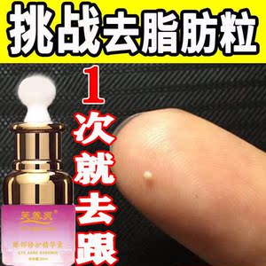 治疗汗管瘤专用药专用膏金霉素眼膏去脂肪粒汗管粒眼部专用膏去除