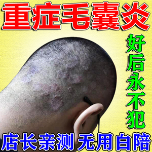 日本毛囊炎