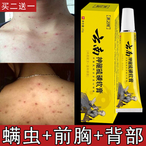 背上长痘痘后背去螨虫药膏人用专用叮咬脸部过敏止痒断根药皮肤病